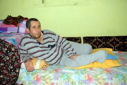 Kangren Olan Ayağı Kesildi